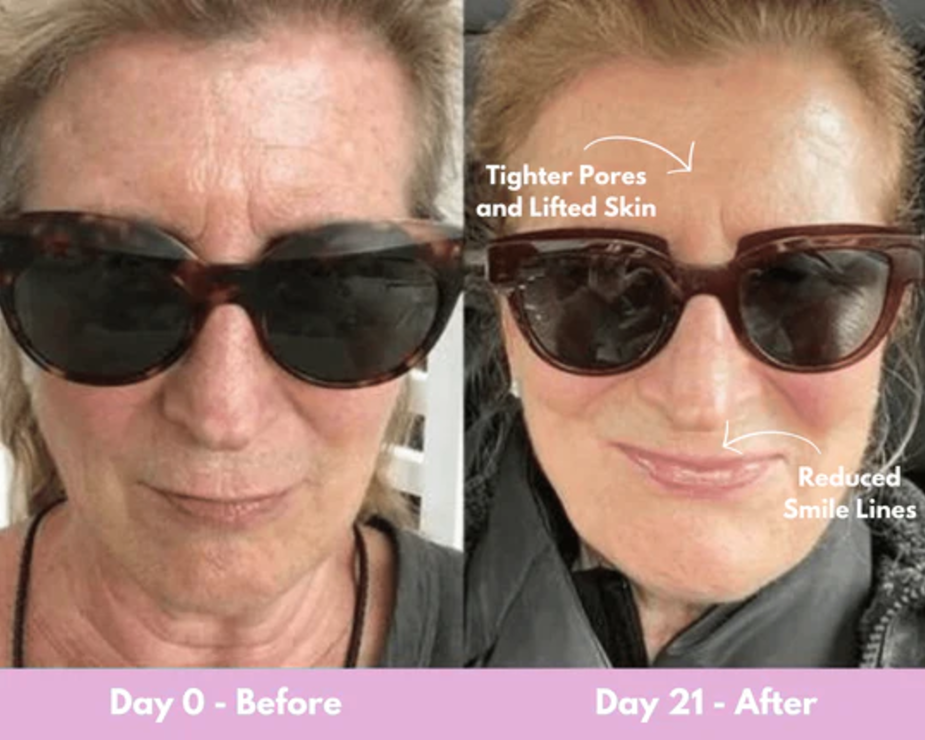 21 days results facial sculptor 3