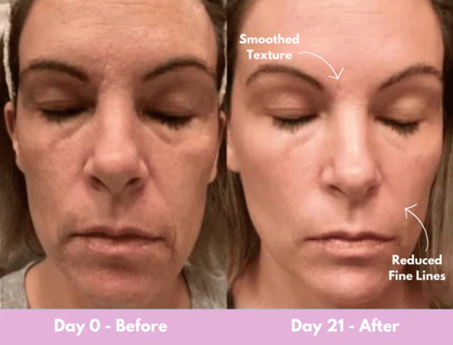 21 days results facial sculptor 2