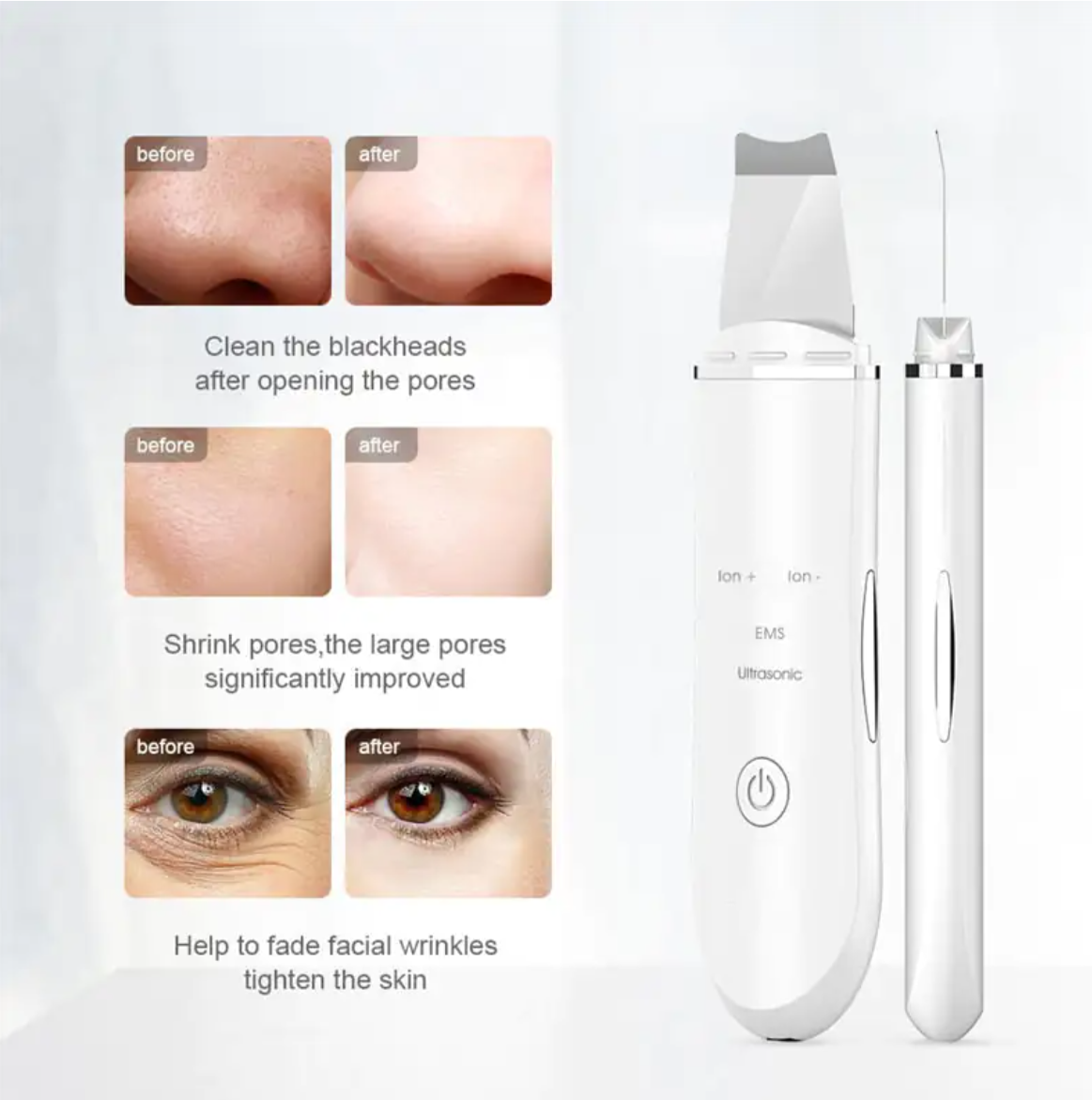 Oui Lovely™ ClearSkin Wand